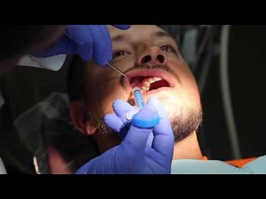 My Technique: How I Use Anutra for an Infiltration