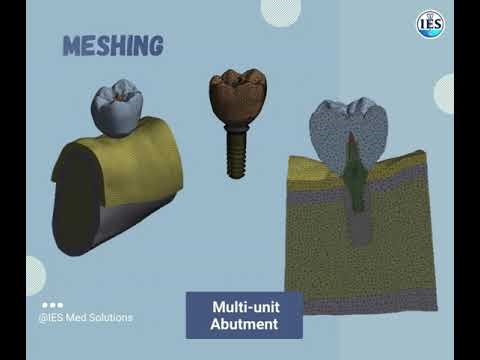 Dental Implantology & Prosthetic Planning