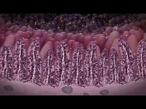 Ileitis - The disease