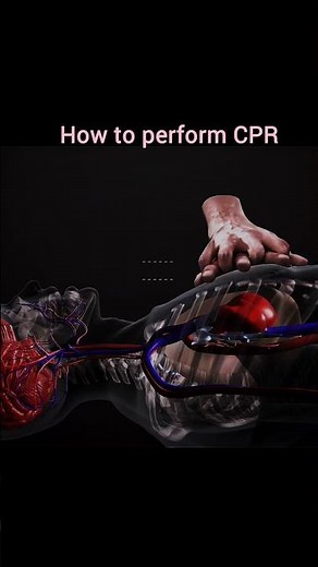 How to Perform CPR Chest Compressions