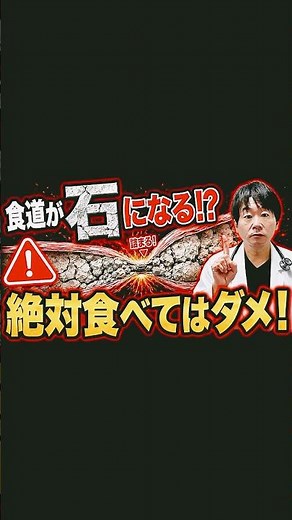 【食道が石になる？】 のどが詰まる病気５選