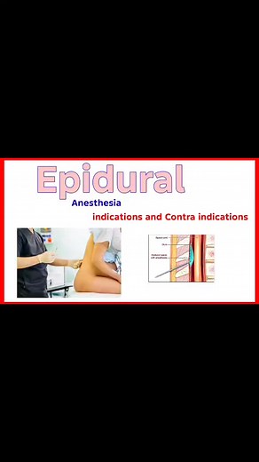 #EpiduralAnesthesia #PainManagement #Childbirth #LaborAndDelivery #AnesthesiaEducation #PregnancyCare #PainRelief #MedicalGuidelines #PatientSafety #AnesthesiaAwareness #ObstetricAnesthesia #Contraindications #EpiduralBenefits #HealthcareProfessionals #MaternityCare #AnesthesiaRisks #PatientEducation #SurgicalAnesthesia #PainControl #EpiduralProcedure | Anaesthesiologist.