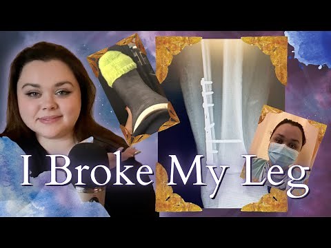 I Was in a Wheelchair for a Month | How Long It Takes a Heal from a Broken Leg