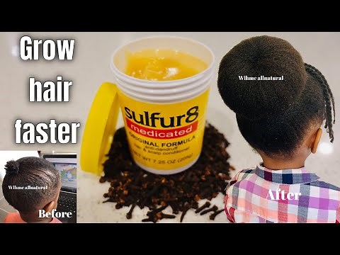 How to use SULPHUR 8 & Cloves for Massive hair growth! Mix Sulphur 8 & cloves for Hair Growth