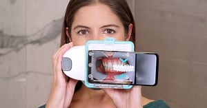 Dental Monitoring system remotely connects orthodontists with patients