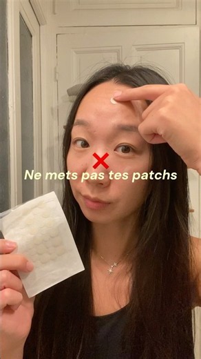 3 boutons où ton patch ne sert presque à rien 😭