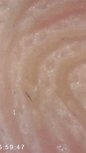 Skin under Microscope