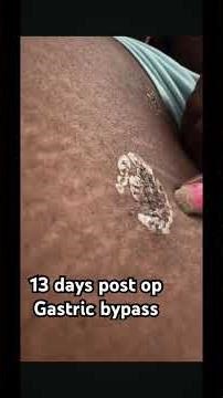 Today's menu for the trolls includes some delicious wounds 💯