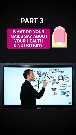 WHAT YOUR NAILS SAY ABOUT YOUR HEALTH 💅 PART 3 Your nails can reveal a lot about your health and nutrition. In Part 3, we break down key signs to watch for and what they mean. 🧬✨ #NailHealth #NutritionTips #WellnessCheck #HealthyNails #NailSigns #SelfCareTips #HolisticHealth #BodySignals #HealthAwareness #FYP | Diet & healthy By Dr