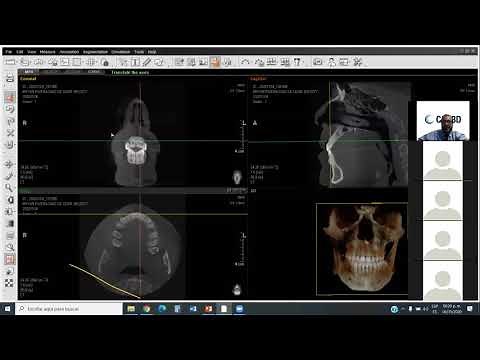 EZ3D Plus Manejo de software de Tomografía Cone Beam. Dr. Enrique Sierra Rosales