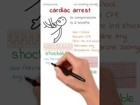 ALS Algorithm | Cardiac Arrest Resus Guide #imgdoctor #nhsjobs