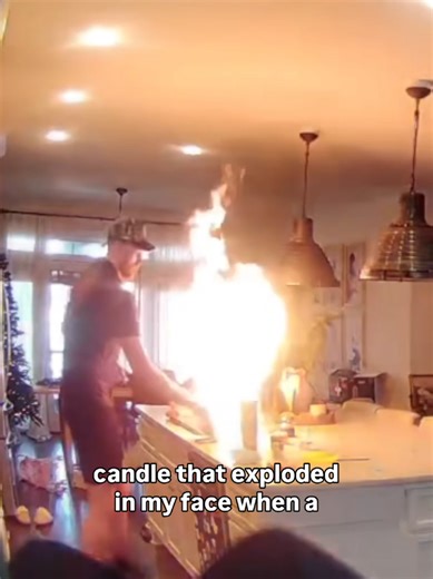 Y'all have asked why my hand was bandaged for a couple months. Be careful. Sharing my experience. No direct outreach beyond a DM telling me to call a customer experience hotline. No email response or calls to me even though info was sent. This resulted in a permanent scar on my hand.