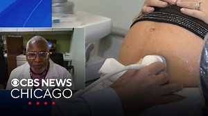 Mortality rate for Black mothers not improving, study shows
