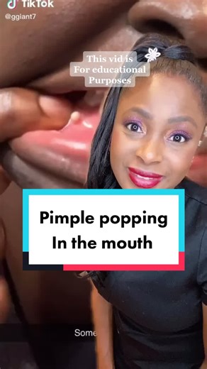 Pimple in Mouth: Causes, Treatment, and Prevention