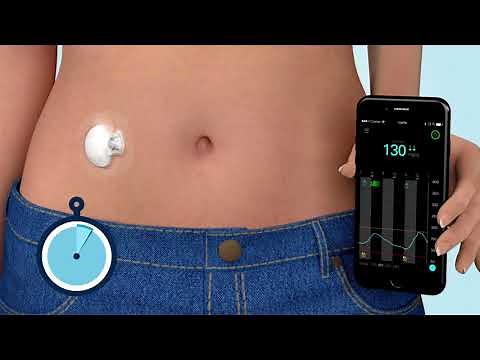 ¿Qué es el monitoreo continuo de glucosa (MCG) personal?