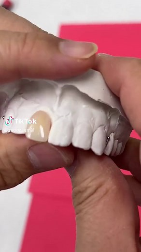 Preventing Cavities: Dental Care Tips and Insights