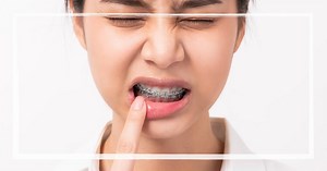 4 Ways How To Relieve Braces Power Chain Pain | [year] Guide