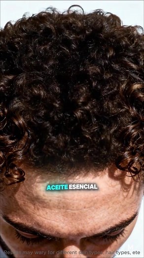 Trattamento Naturale per la Perdita di Capelli