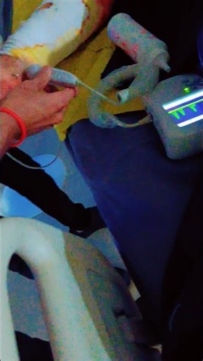 How to check pulse by Doppler machine 🩸🫨| #pulse #vigo #hospital #doppler #neet #shorts