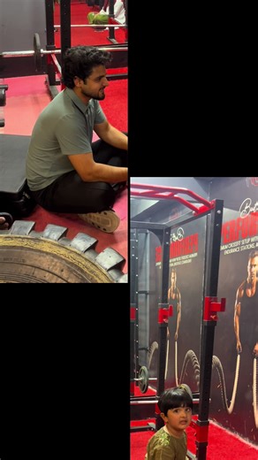 Cupping Therapy for Children with Cerebral Palsy