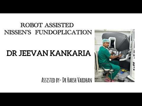 Robot Assisted Floppy Nissen's Fundoplication| Dr Jeevan Kankaria