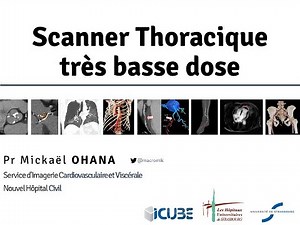 Scanner thoracique très basse dose : définitions, acquisitions, indications et limites