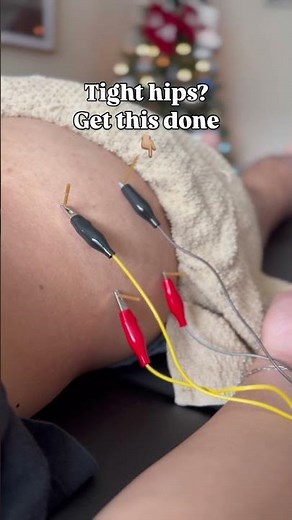 Needles + estim combo for hip pain 😱