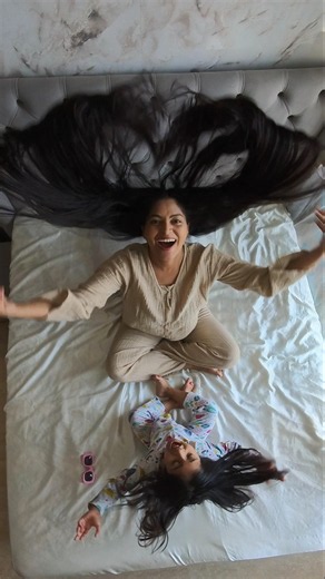 This Ayurvedic Trick Turned My Bald Hair Into Massive Hairgrowth #shorts #ytshorts #youtubeshorts