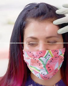 #pimplepopper #drpimplepoppers #cyst #cystremoval #pimplepopping #cyst #cystremoval #pimplepopping #skincareroutine #blackheadremoval #satisfyingvideos | pimple treatment