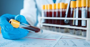 eGFR Nedir, Neden Olur ve Normal Değeri Kaç Olmalı? eGFR Düşüklüğü Belirtileri | Sağlık Haberleri