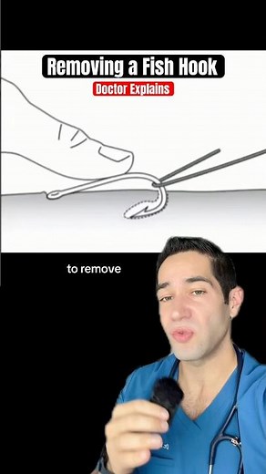 How to SAFELY remove a fish hook