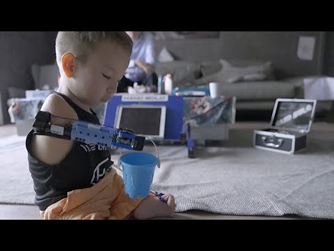 8-Year-Old Boy’s New Prosthetic Arm Made of Legos