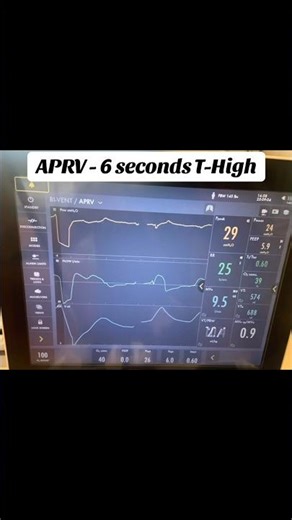 APRV Explained | Why Increasing Time High Improves Oxygenation #respiratorytherapy #ventilator