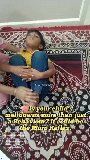 💛While the Moro reflex is not the sole cause of autism. 👉 Interventions focused on integrating retained reflexes, often in the form of specialized therapies, may help improve sensory processing, motor skills, and emotional regulation. 💛✨️Autism and Retained Moro Reflex: 👉In some children with autism, the Moro reflex may persist or be exaggerated beyond the expected age. 👉Impact on Sensory Processing: A retained or exaggerated Moro reflex can lead to hypersensitivity to sensory input, making