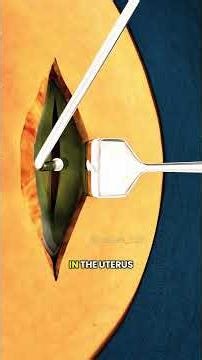 C-Section Procedure Explained Simply| Medical Animation for Students & Parents