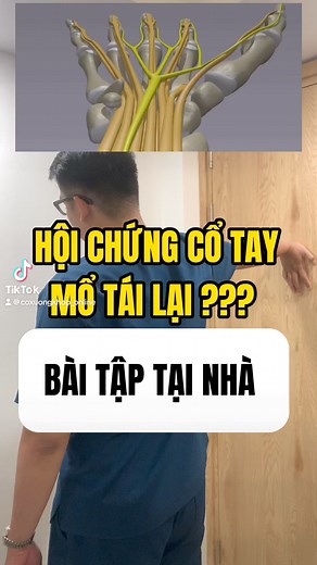 BÀI TẬP HỖ TRỢ TÊ TAY Phòng Khám TriggerPoint Therapy | Nguyễn Hoàng