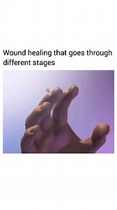 Biology on Instagram: "The four phases of wound healing. The complicated mechanism of wound healing occurs in four phases: hemostasis, inflammation, proliferation, and remodelling. In purple migratory cells fibroblasts are critical in supporting normal wound healing, involved in key processes such as breaking down the fibrin clot, creating new extra cellular matrix (ECM) and collagen structures to support the other cells associated with effective wound healing, as well as contracting the wound. 