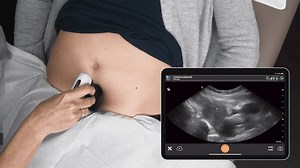 Pelvic Ultrasound IUD | Clarius
