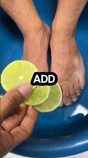 Stop Cracked Heels Forever | Easy Foot Care Routine at Home #skincare