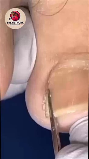 Expert Advice for Help Foot Pain Sufferers Care for Your Feet Naturally #NailCareTips #SimpleHealthTricks #HealthyHabits #FootWellnessUSA | Bye