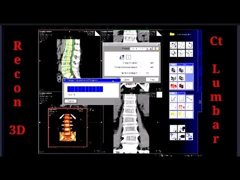 LEARN RECONSTRUCTION CT LUMBAR SCAN || Siemens 16 Slice