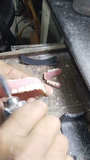 Soft Lining Complete Denture Final Finishing With Sandpaper 😁😁😁#softdenture #dentures #viralvideo