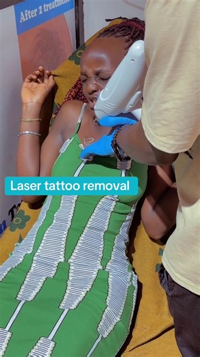Discover Laser Tattoo Removal Services at New Pioneer Mall