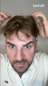 Quick Hair System Removal: Scalp-Friendly Steps You Can Follow!😏| Lavivid hair system