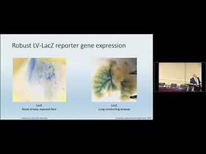 Lentivirus-mediated Gene Transfer in Stem Cells for Correction of Cystic Fibrosis Defect in Airway