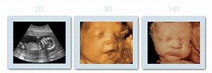 faq's - First Glimpse Ultrasound