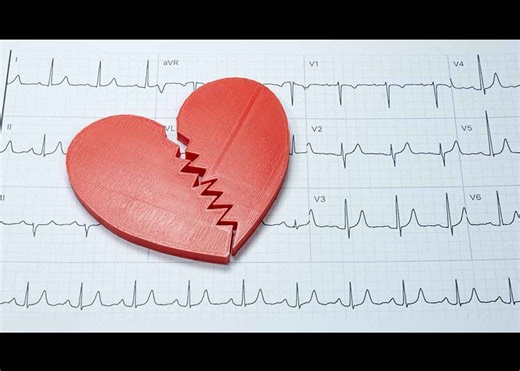 Tracing the Decline in American Heart Disease Mortality
