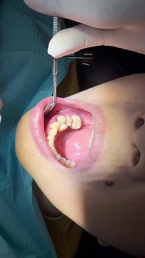 Understanding Dental Procedures and Oral Health Care