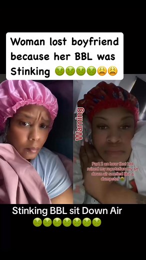7.3K views · 8.4K reactions | Woman says she had her BBL surgically removed because it was stinking 濫濫 She said she even lost her boyfriend behind her stinking 濫濫BBL! WOW  #bbl #funkysitdownair #plasticsurgerygonewrong | Tina Lampo | Facebook