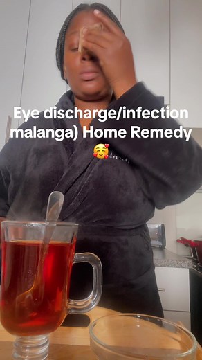 Effective Eye Discharge Remedy for Children - Natural and Easy